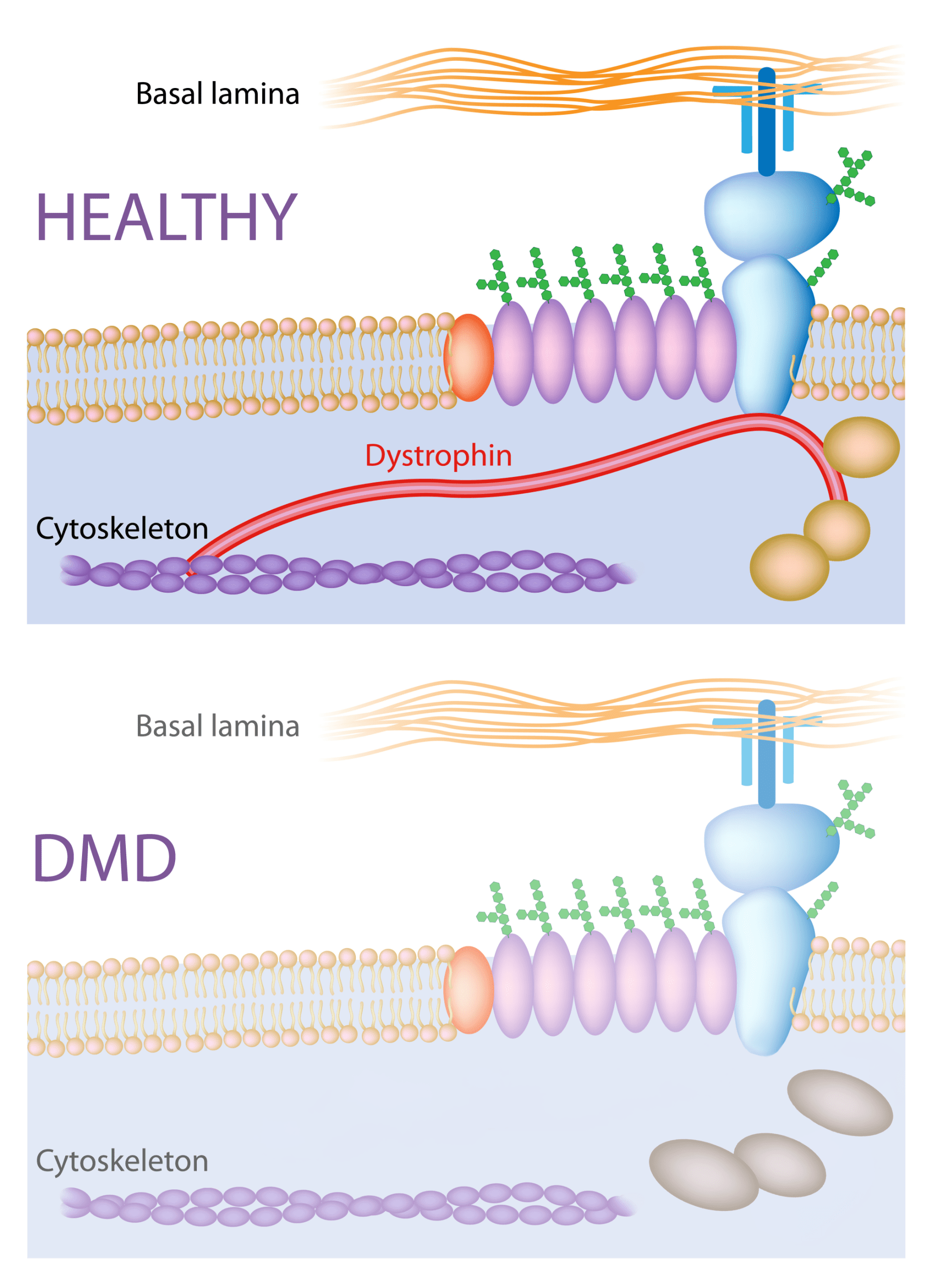Dystrophin DMD